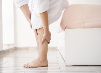 prevenire le vene varicose