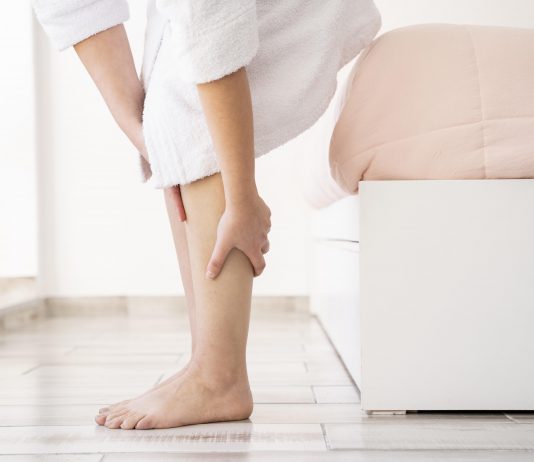 prevenire le vene varicose